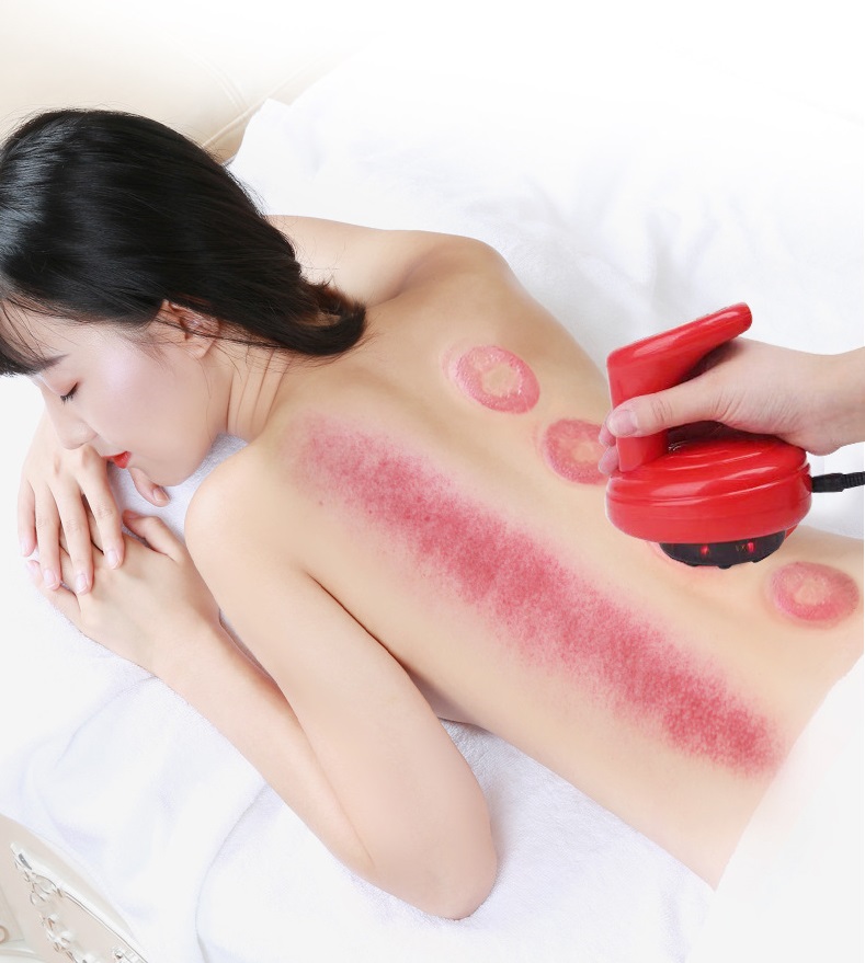 Máy Massage Giác Hơi Điện Tử